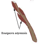 adpressé